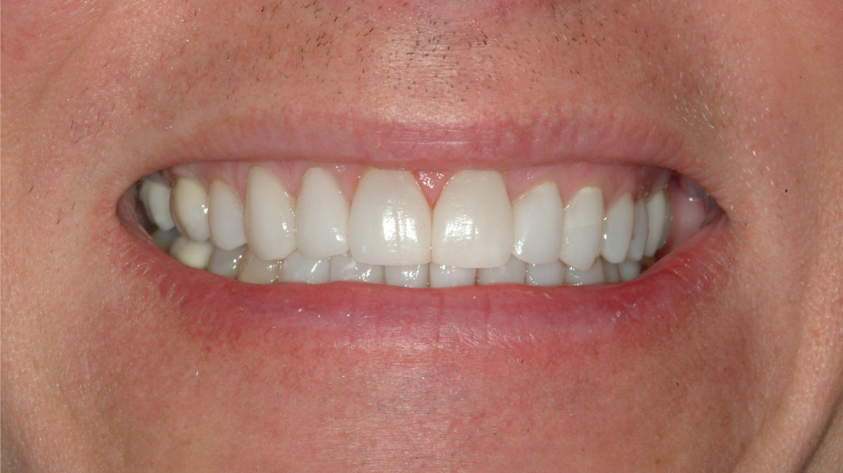 Ed-after
