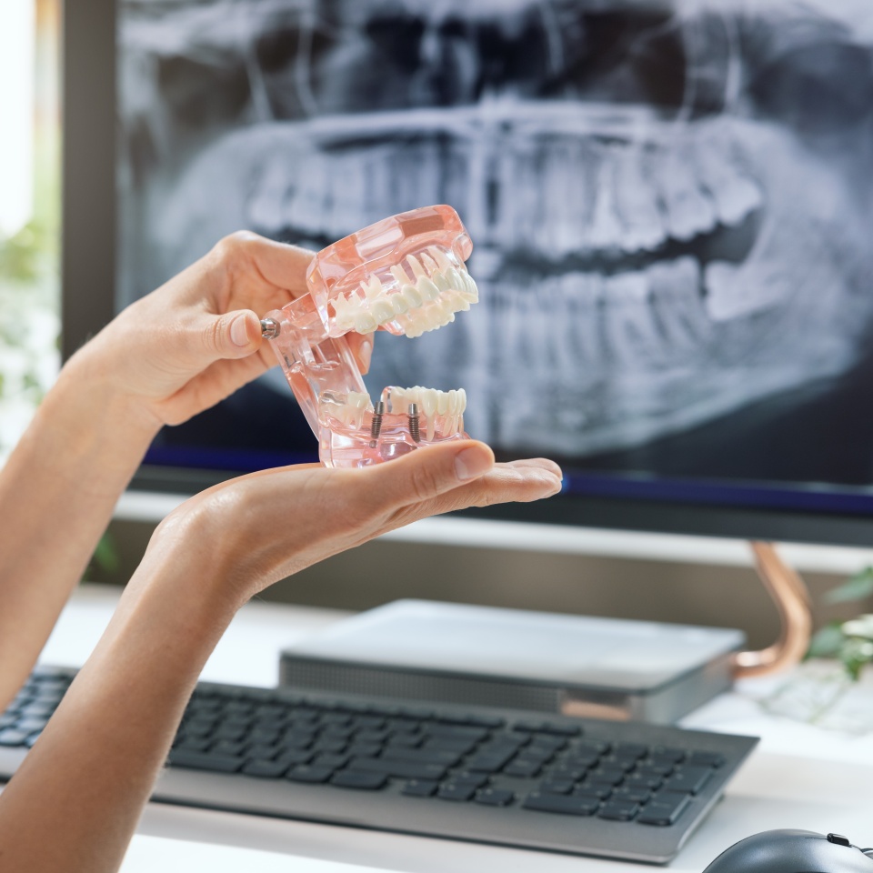 dentist implantologist showing teeth model with implant screw sample in clinics office