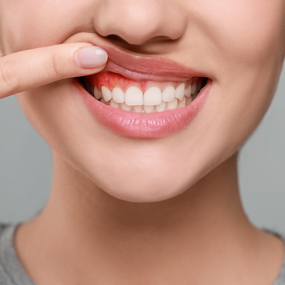 Woman showing inflamed gum on grey background, closeup