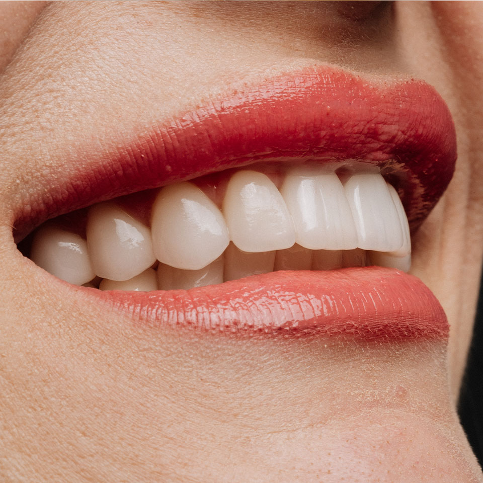 Close-up of a person's mouth with red lipstick, showing white teeth in a slight smile.