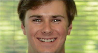 Patient after Invisalign procedure