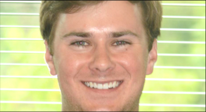 Patient before Invisalign procedure