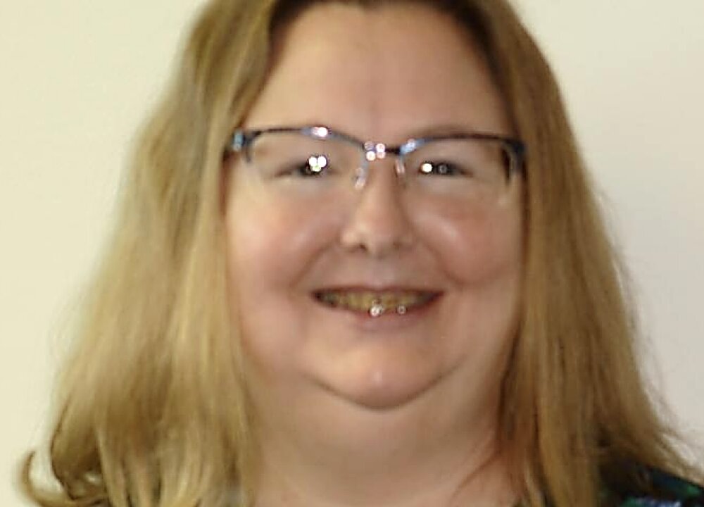 Patient before crowns procedure